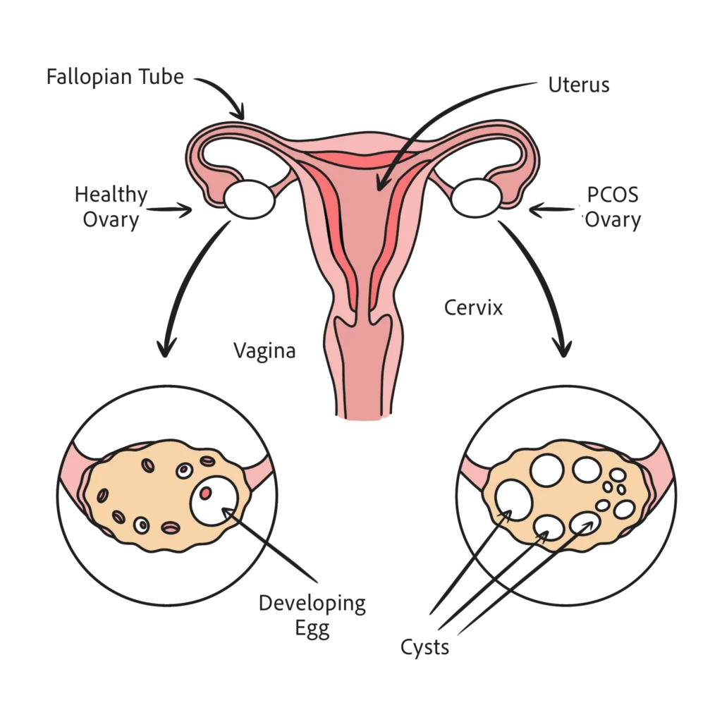 ovaries diagram 